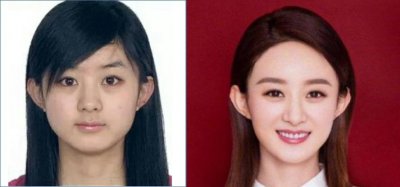 ​娱乐圈扒皮系列——第三期，赵丽颖整容史