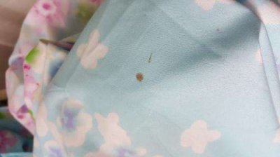 衣服血迹如何洗掉小妙招(清洗陈旧的血渍的最佳办法)