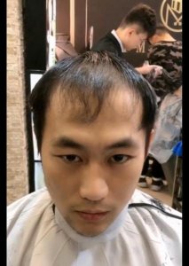 头顶头发稀少适合烫什么发型(头顶发量少的发型)