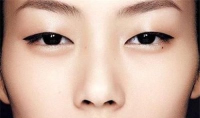​单眼皮变双眼皮方法，单眼皮快速变双眼皮有哪些方法？