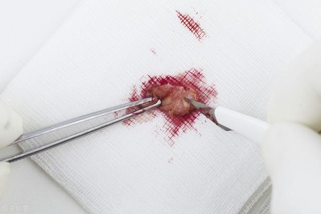 少年武功极高失传已久的武林绝学（欲练神功挥刀自宫）(7)