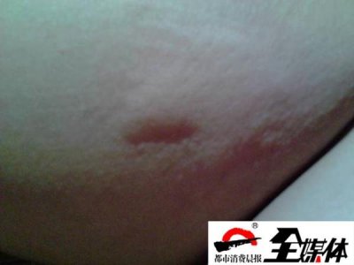 ​乌鲁木齐这户居民家中法老蚁肆虐，每天能抓200只