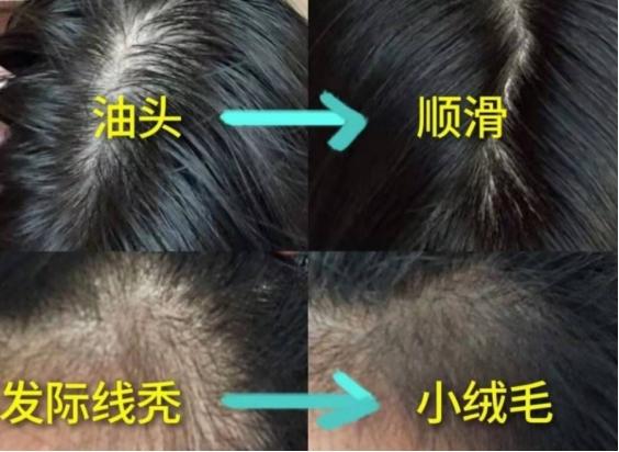 适合孕期使用的洗发水推荐(盘点4款高口碑孕妇洗发水)(2)