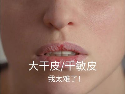 ​敏感肌适合用什么护肤品（什么护肤品好用又实惠排名）