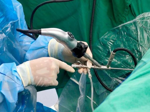 什么叫微创手术怎么做(何为微创手术)(2)