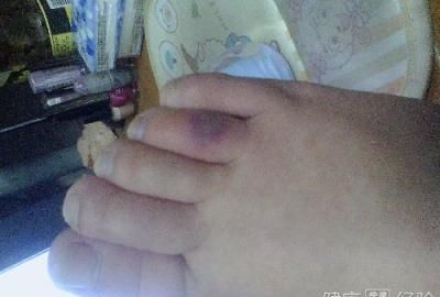 因为工作环境不好，老公一到冬天就冻脚，该怎么办