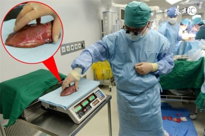 ​肝病吃什么好（5个食疗秘方教你养肝护肝）