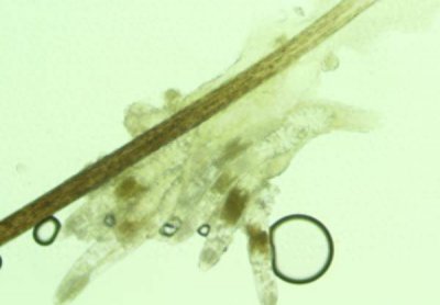 ​眼晴越揉越痒痒吃什么药好 眼晴越揉越痒用什么药