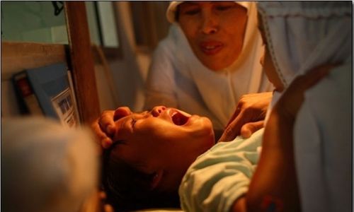 非洲割礼是割哪些东西