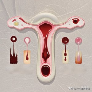 ​第十讲：经期出血颜色变化，意味着什么