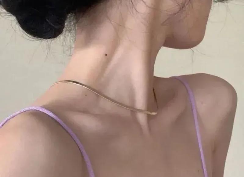 蒜头鼻整形图片(蒜头鼻作为公认最丑的鼻型) 蒜头鼻整形图片(蒜头鼻作为公认最丑的鼻型)