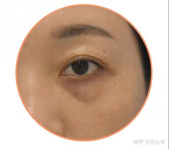 ​24岁女生学什么技术好，24岁的年龄学什么技术好？
