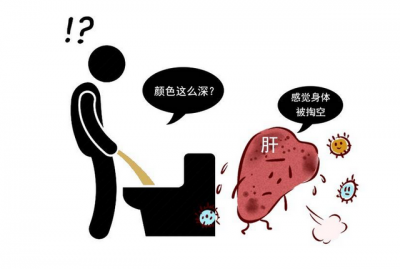 ​女性尿液发黄是什么原因(女性尿液发黄是什么原因怎么治疗)