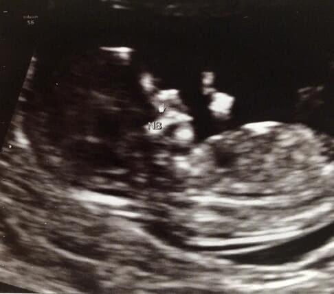 欧弟二胎最新（欧弟宣布怀二胎）(4)